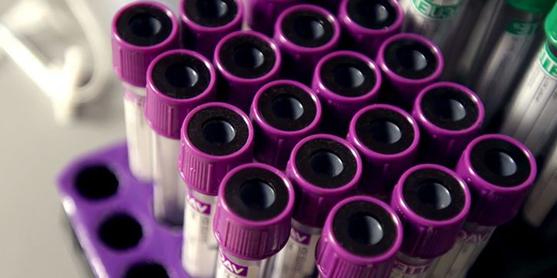 Spanish public hospitals pay 307,200 euros for each personalised childhood leukaemia treatment